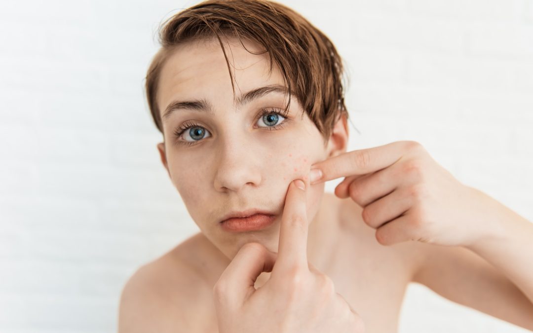 Clearing the Path to Healthy Skin: Teenagers’ Dos and Don’ts